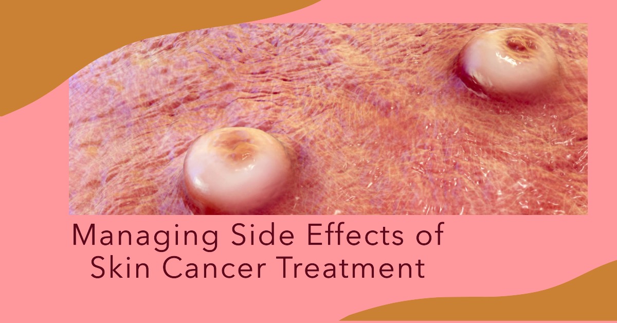 Side Effects of Skin Cancer Treatment