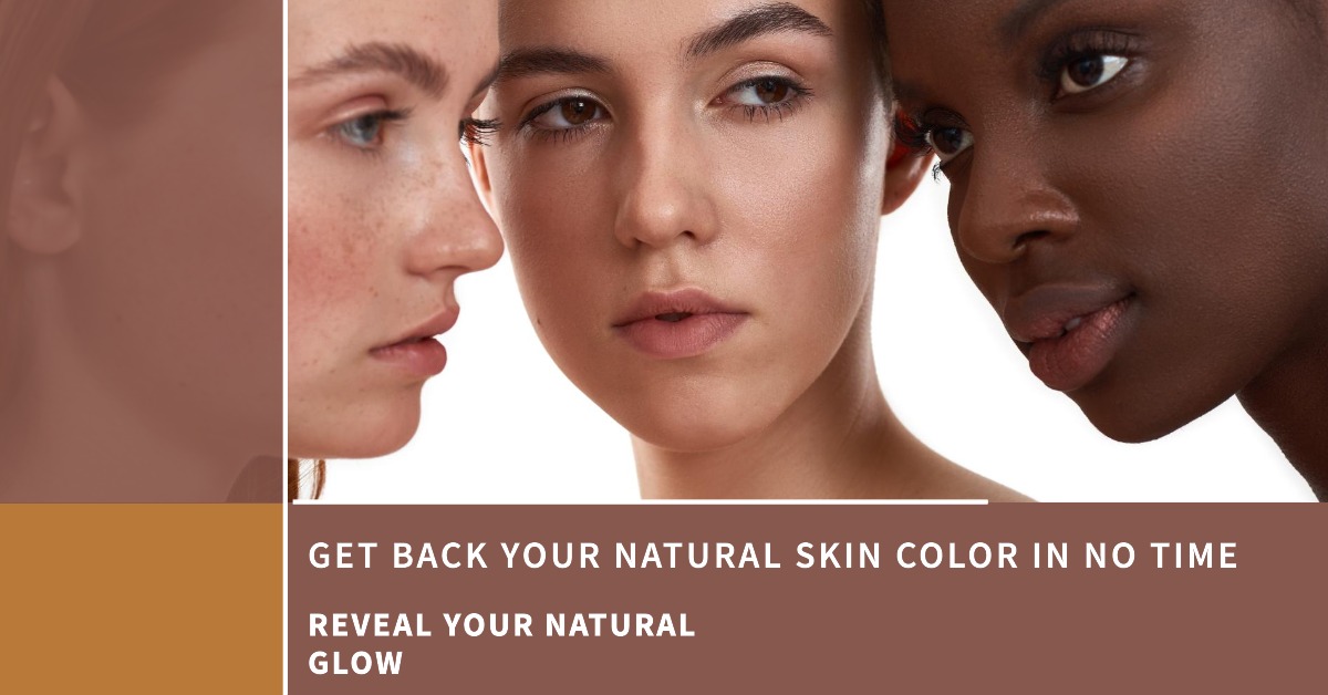 How to Get Your Natural Skin Color Back Fast